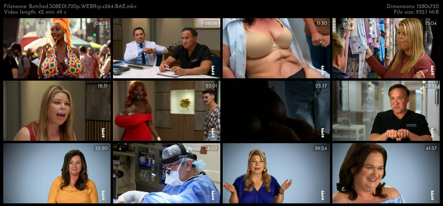 Botched S08E01 720p WEBRip x264 BAE TGx