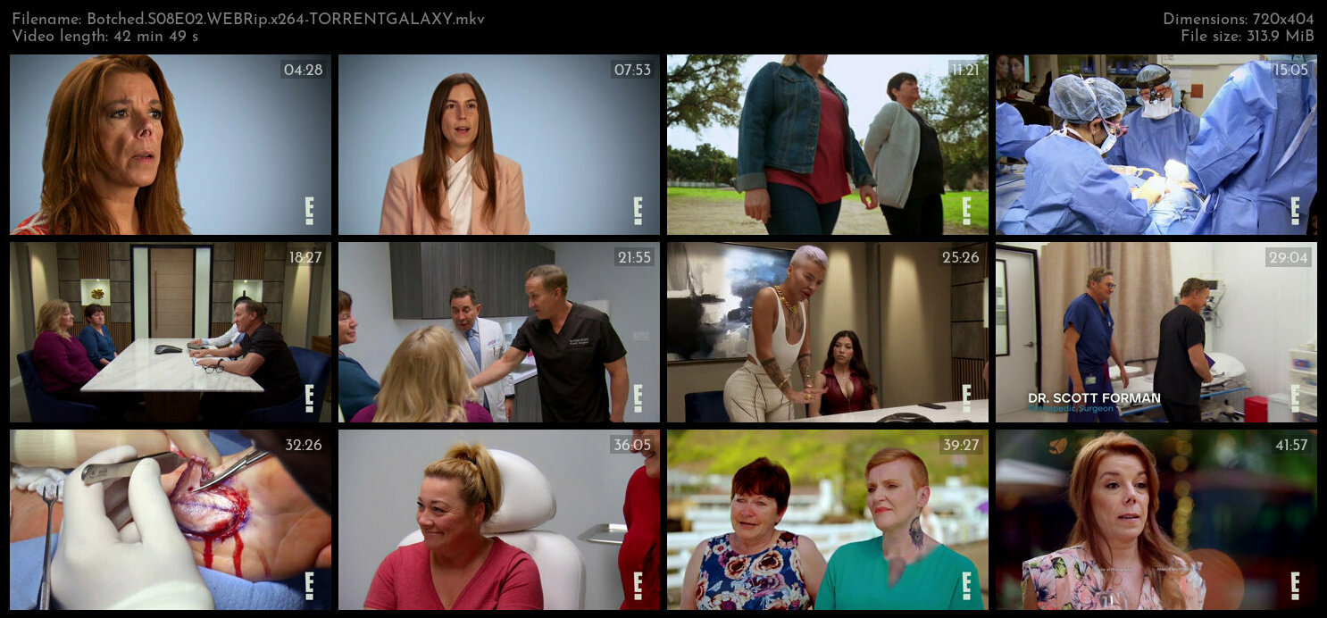 Botched S08E02 WEBRip x264 TORRENTGALAXY