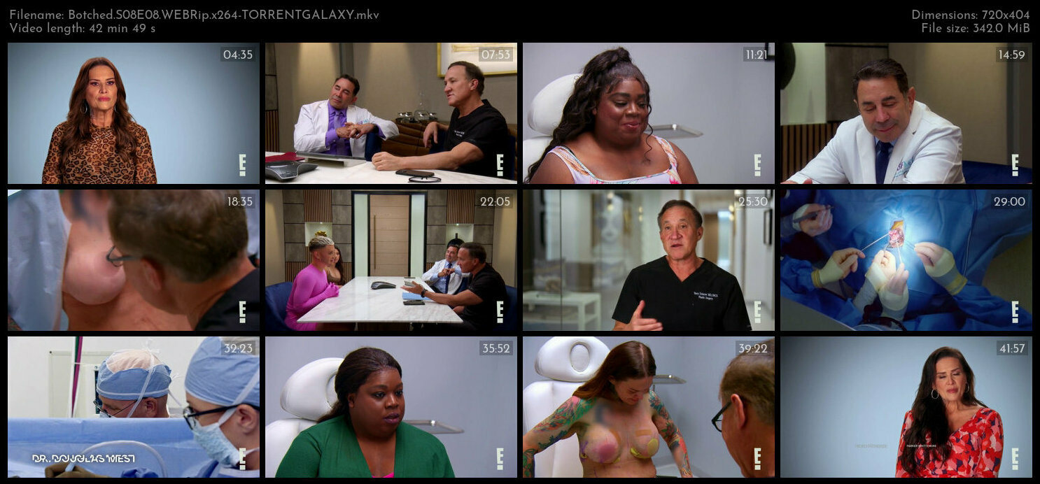 Botched S08E08 WEBRip x264 TORRENTGALAXY