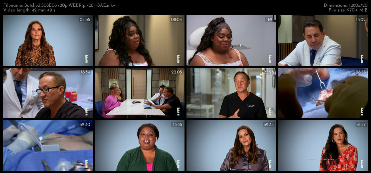 Botched S08E08 720p WEBRip x264 BAE TGx