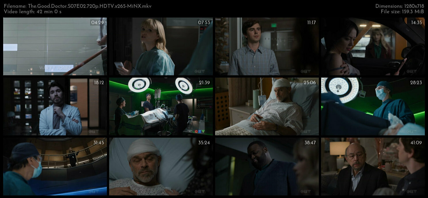 The Good Doctor S07E02 720p HDTV x265 MiNX TGx
