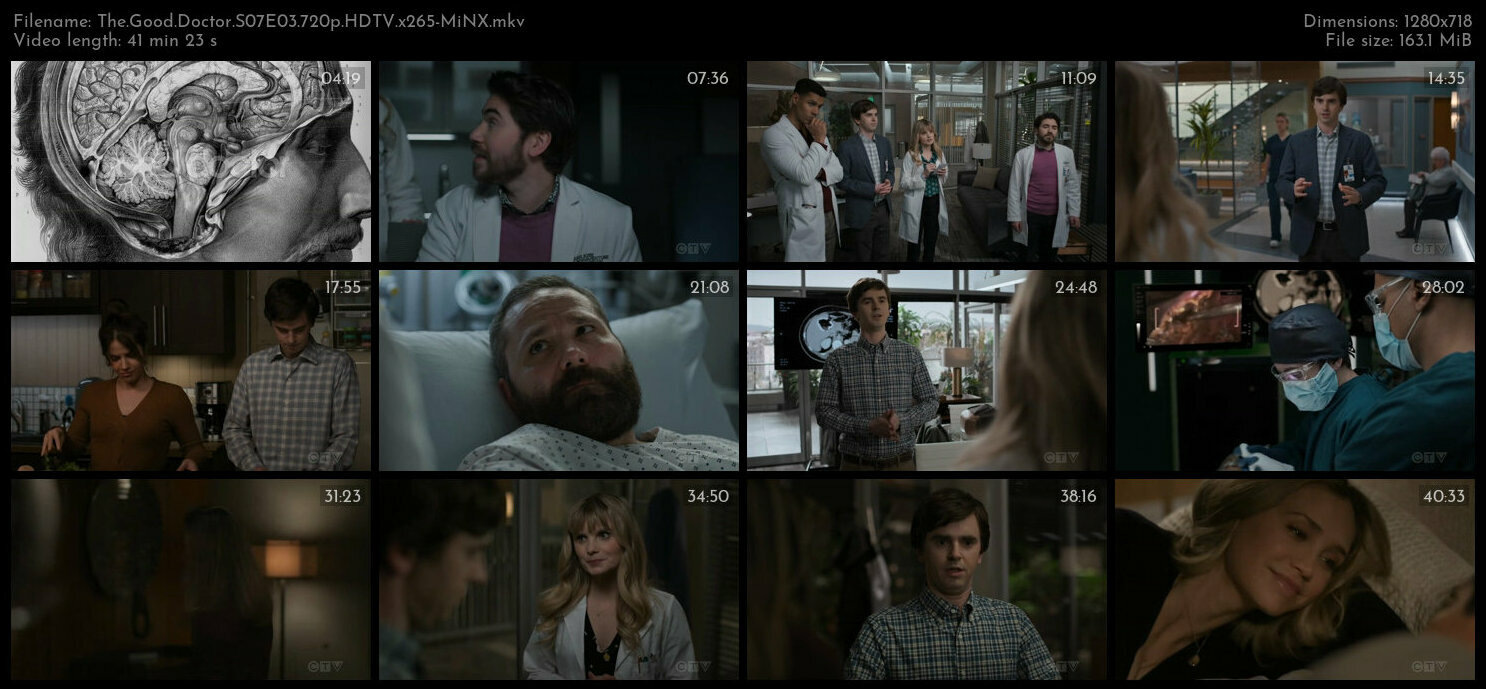 The Good Doctor S07E03 720p HDTV x265 MiNX TGx