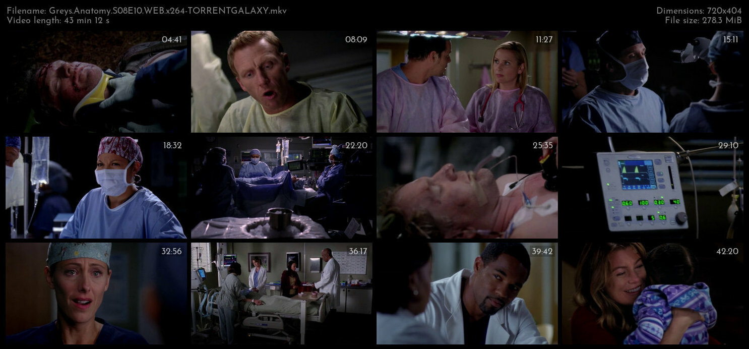 Greys Anatomy S08E10 WEB x264 TORRENTGALAXY