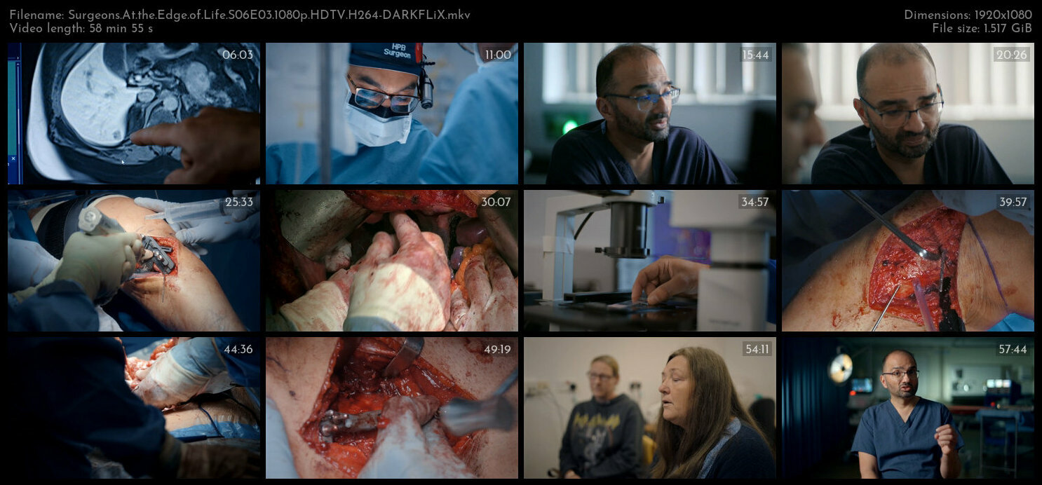 Surgeons At the Edge of Life S06E03 1080p HDTV H264 DARKFLiX TGx