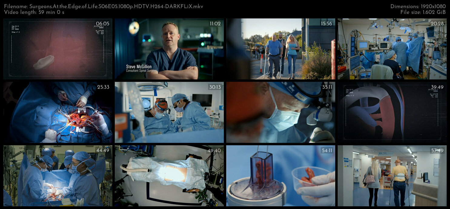 Surgeons At the Edge of Life S06E05 1080p HDTV H264 DARKFLiX TGx