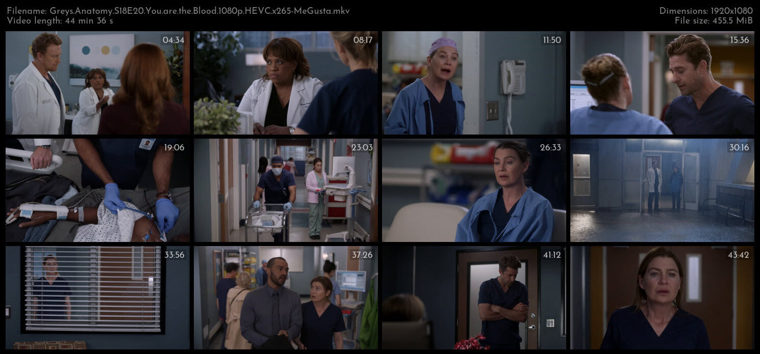 Greys Anatomy S18E20 You are the Blood 1080p HEVC x265 MeGusta TGx